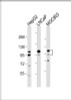 Western Blot at 1:2000 dilution Lane 1: HepG2 whole cell lysate Lane 2: LNCaP whole cell lysate Lane 3: MGC803 whole cell lysate Lysates/proteins at 20 ug per lane.