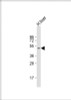 Western Blot at 1:1000 dilution + human liver lysate Lysates/proteins at 20 ug per lane.