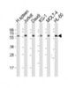 Western Blot at 1:2000 dilution Lane 1: human spleen lysates Lane 2: Jurkat whole cell lysates Lane 3: Daudi whole cell lysates Lane 4: KG-1 whole cell lysates Lane 5: MOLT-4 whole cell lysates Lane 6: HL-60 whole cell lysates Lysates/proteins at 20 ug per lane.