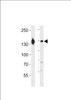 Western blot analysis in A431 cell line and human placenta tissue lysates (35ug/lane) .
