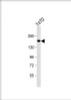 Western Blot at 1:1000 dilution + T47D whole cell lysate Lysates/proteins at 20 ug per lane.