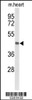 Western blot analysis of DBC1 Antibody in mouse heart tissue lysates (35ug/lane)