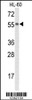 Western blot analysis of NYX Antibody in HL-60 cell line lysates (35ug/lane)