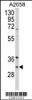 Western blot analysis of ING5 Antibody in A2058 cell line lysates (35ug/lane)