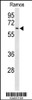 Western blot analysis of EIF2A Antibody in Ramos cell line lysates (35ug/lane)