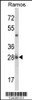 Western blot analysis of NUCKS1 Antibody in Ramos cell line lysates (35ug/lane)