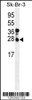 Western blot analysis of CHMP4B Antibody in SK-BR-3 cell line lysates (35ug/lane)