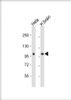 Western Blot at 1:1000 dilution Lane 1: Hela whole cell lysate Lane 2: human brain lysate Lysates/proteins at 20 ug per lane.