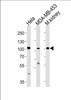 Western blot analysis in Hela, MDA-MB-453 cell line and mouse kidney tissue lysates (35ug/lane) .