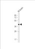 Western blot analysis in MCF-7 cell line and mouse liver, brain tissue lysates (35ug/lane) .