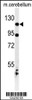 Western blot analysis of KIF6 Antibody in mouse cerebellum tissue lysates (35ug/lane)