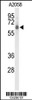 Western blot analysis of CLPTM1L Antibody in A2058 cell line lysates (35ug/lane)