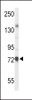 Western blot analysis of CHAT Antibody in mouse liver tissue lysates (35ug/lane)