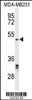 Western blot analysis of CBX2 Antibody in MDA-MB231 cell line lysates (35ug/lane)