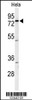 Western blot analysis of CLPTM1 Antibody in Hela cell line lysates (35ug/lane)