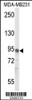 Western blot analysis of IL17RD Antibody in MDA-MB231 cell line lysates (35ug/lane)