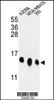 Western blot analysis of RPL36 Antibody in A2058, MDA-MB435, 293 cell line lysates (35ug/lane)