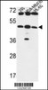 Western blot analysis in 293, MDA-MB435, HL-60 cell line lysates (35ug/lane) .