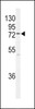 Western blot analysis of K0776 Antibody in MCF-7 cell line lysates (35ug/lane)