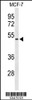 Western blot analysis of FLVC2 Antibody in MCF-7 cell line lysates (35ug/lane)