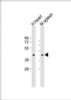 Western Blot at 1:2000 dilution Lane 1: human heart lysate Lane 2: mouse spleen lysate Lysates/proteins at 20 ug per lane.