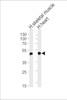 Western blot analysis of lysates from human skeletal muscle and heart tissue lysates (from left to right) , using HFE2 Antibody at 1:1000 at each lane.