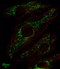 Immunofluorescent analysis of Hela cells, using SLC25A37 Antibody . Antibody was diluted at 1:25 dilution. Alexa Fluor 488-conjugated goat anti-rabbit lgG at 1:400 dilution was used as the secondary antibody (green) . Cytoplasmic actin was counterstained with Dylight Fluor 554 (red) conjugated Phalloidin (red) .