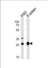 Western blot analysis in K562 cell line and rat spleen tissue lysates (35ug/lane) .