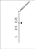 Western Blot at 1:2000 dilution + human skeletal muscle lysate Lysates/proteins at 20 ug per lane.