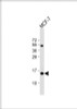 Western Blot at 1:1000 dilution + MCF-7 whole cell lysate Lysates/proteins at 20 ug per lane.