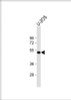 Western Blot at 1:1000 dilution + U-2OS whole cell lysate Lysates/proteins at 20 ug per lane.