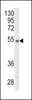 Western blot analysis of P2R3C Antibody in Y79 cell line lysates (35ug/lane)