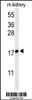 Western blot analysis of LYPD1 Antibody in mouse kidney tissue lysates (35ug/lane)