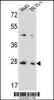 Western blot analysis in A549, ZR-75-1 cell line lysates (35ug/lane) .
