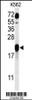 Western blot analysis of GAGE7 Antibody in K562 cell line lysates (35ug/lane)