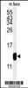 Western blot analysis of TMIE Antibody in mouse liver tissue lysates (35ug/lane)