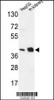 Western blot analysis in HepG2 cell line and mouse kidney tissue lysates (35ug/lane) .