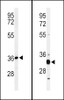 Western blot analysis of ST8SIA4 Antibody in HL-60 cell line lysates (35ug/lane) Western blot analysis of ST8SIA4 Antibody in mouse spleen tissue lysates (35ug/lane)