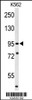 Western blot analysis of SUPV3L1 Antibody in K562 cell line lysates (35ug/lane)