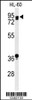 Western blot analysis of PATL1 Antibody in HL-60 cell line lysates (35ug/lane)