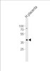 Western blot analysis of lysate from human placenta tissue lysate, using IDH3G Antibody at 1:1000 at each lane.