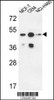 Western blot analysis in MCF-7, CEM, NCI-H460 cell line lysates (35ug/lane) .