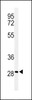 Western blot analysis of RHG19 Antibody in T47D cell line lysates (35ug/lane)