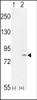 Western blot analysis of FGFR1 using rabbit polyclonal FGFR1-Y307 using 293 cell lysates (2 ug/lane) either nontransfected (Lane 1) or transiently transfected with the FGFR1 gene (Lane 2) .