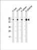 Western Blot at 1:2000 dilution Lane 1: human liver lysate Lane 2: human lung lysate Lane 3: human spleen lysate Lane 4: human plasma lysate Lysates/proteins at 20 ug per lane.