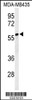 Western blot analysis of NARFL Antibody in MDA-MB435 cell line lysates (35ug/lane)