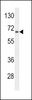 Western blot analysis of lysate from HepG2 cell line, using AGXT2 Antibody at 1:1000 at each lane.