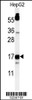 Western blot analysis of TYROBP Antibody in HepG2 cell line lysates (35ug/lane)