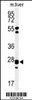 Western blot analysis of GSTK1 Antibody in mouse liver tissue lysates (35ug/lane)