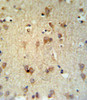 LCAT Antibody IHC analysis in formalin fixed and paraffin embedded brain tissue followed by peroxidase conjugation of the secondary antibody and DAB staining.